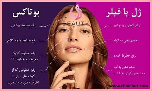 تزریق ژل یا بوتاکس؟ کدام یک بهتر است؟