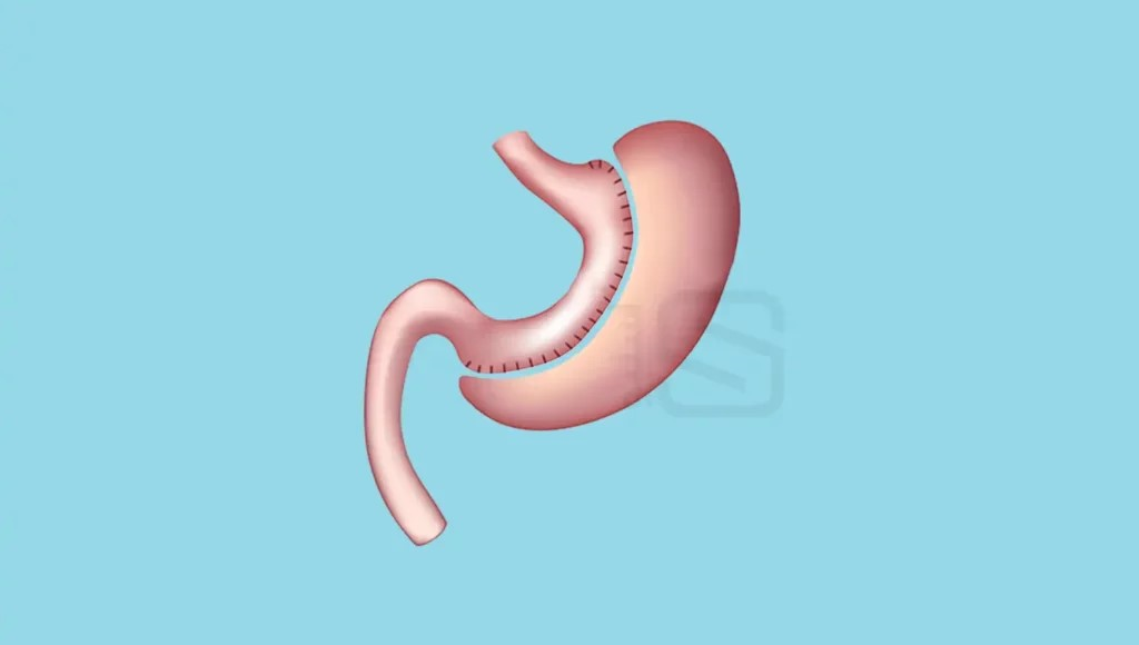 با بدترین روش های لاغری آشنا شوید (بدترین های دنیا) 2