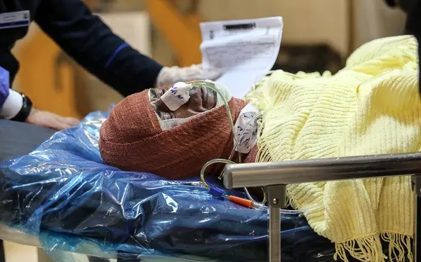 مصدومان-ترقه