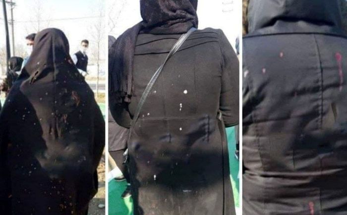 اسیدپاشی بر صورت زنان تمامی ندارد